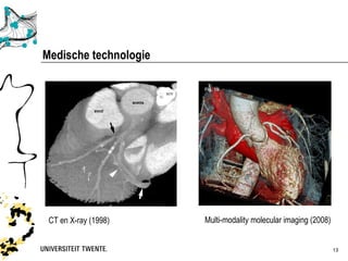 Medische technologie




 CT en X-ray (1998)    Multi-modality molecular imaging (2008)


                                                                 13
 