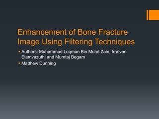 Enhancement of Bone Fracture
Image Using Filtering Techniques
 Authors: Muhammad Luqman Bin Muhd Zain, Irraivan
Elamvazuthi and Mumtaj Begam
 Matthew Dunning
 