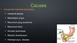 Causes
• Congenital Intestinal obstruction
 Intestinal atresia
 Malrotation of gut
 Meconium plug syndrome
 Meconium ileus
 Annular pancrease
 Mickel’s diverticulum
 Hirshsprung’s disease
 