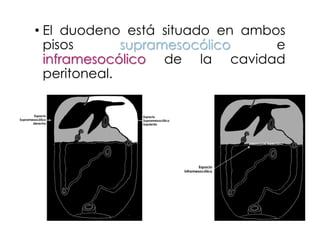 • El duodeno está situado en ambos
pisos supramesocólico e
inframesocólico de la cavidad
peritoneal.
Espacio
Supramesocólico
derecho
Espacio
Supramesocólico
izquierdo
Espacio
inframesocólico
MESOCOLON TRANSVERSO
 