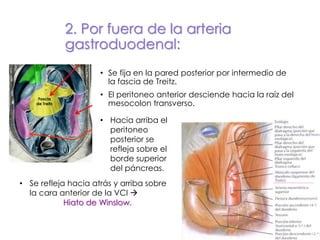 • Se fija en la pared posterior por intermedio de
la fascia de Treitz.
• El peritoneo anterior desciende hacia la raíz del
mesocolon transverso.
2. Por fuera de la arteria
gastroduodenal:
Fascia
de Treitz
• Hacia arriba el
peritoneo
posterior se
refleja sobre el
borde superior
del páncreas.
• Se refleja hacia atrás y arriba sobre
la cara anterior de la VCI 
Hiato de Winslow.
 