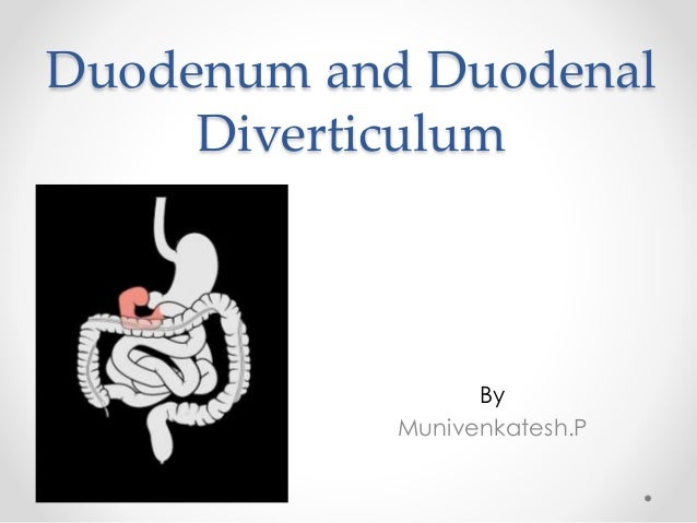 Duodenum And Duodenal Diverticulum