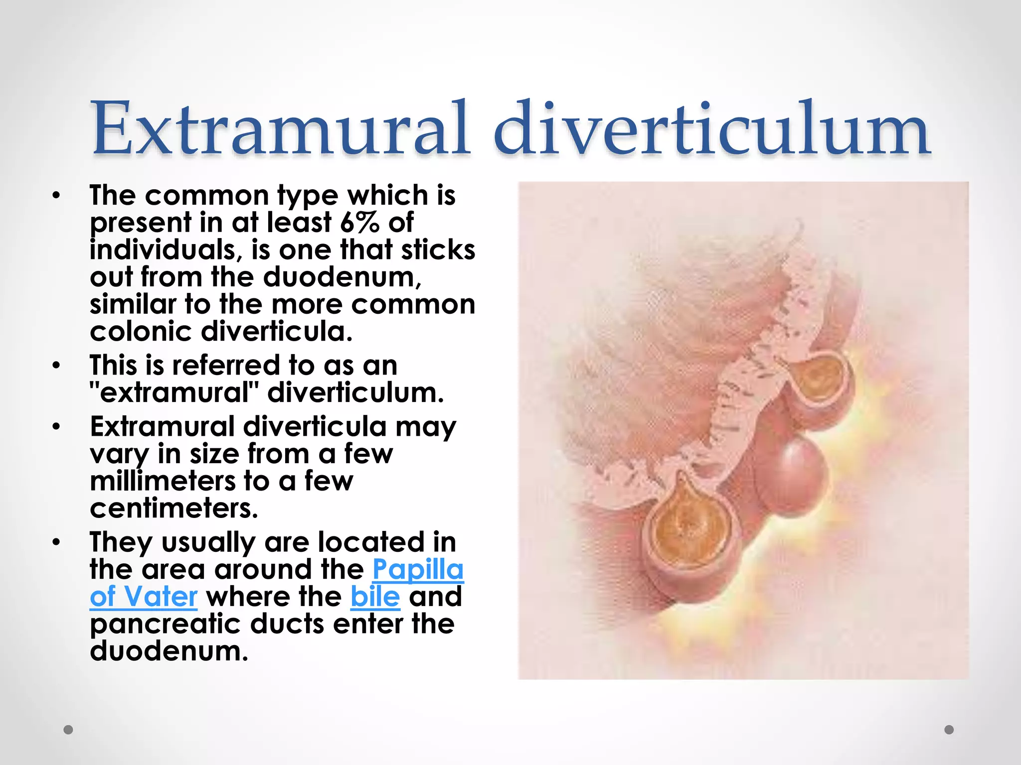 duodenum-and-duodenal-diverticulum-pptx