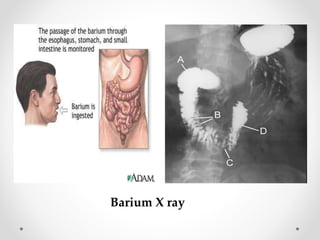 Barium X ray
 