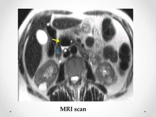 MRI scan
 
