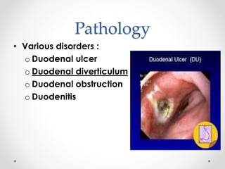 Pathology
• Various disorders :
o Duodenal ulcer
o Duodenal diverticulum
o Duodenal obstruction
o Duodenitis
 