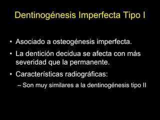 Dentinogénesis Imperfecta 