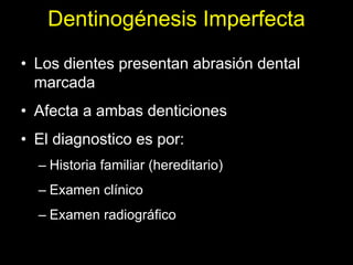 Dentinogénesis Imperfecta 