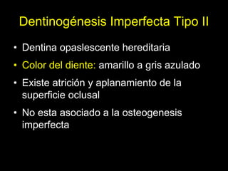 Dentinogénesis Imperfecta 