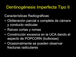 Dentinogénesis Imperfecta 