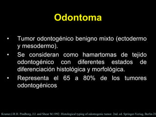 Odontoma