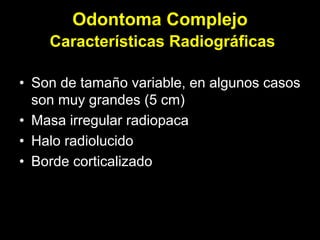 Odontoma