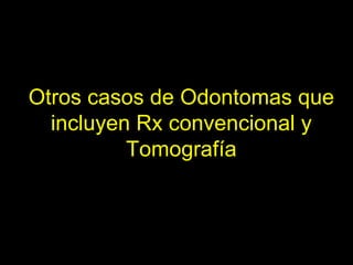 Odontoma