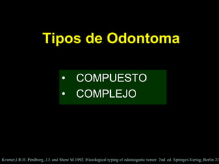 Odontoma