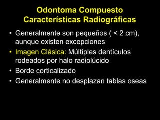 Odontoma