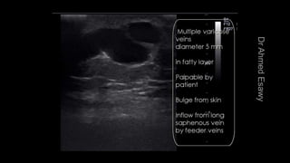 Duplex peripheral veins
