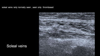 Duplex peripheral veins