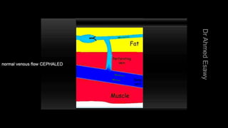 Duplex peripheral veins