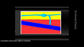 Duplex peripheral veins