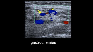 Duplex peripheral veins