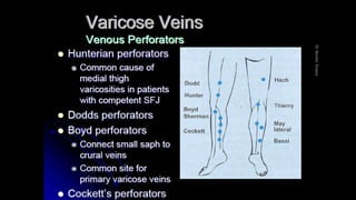 Duplex peripheral veins