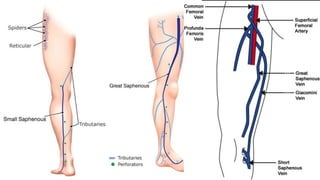 Duplex peripheral veins