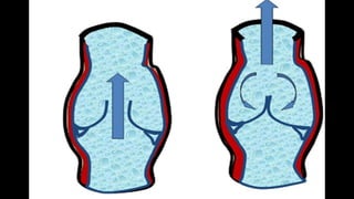 Duplex peripheral veins