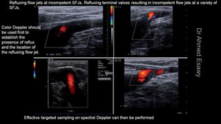 Duplex peripheral veins