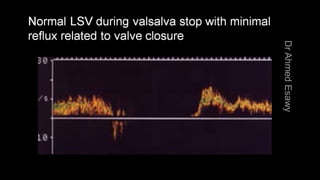 Duplex peripheral veins