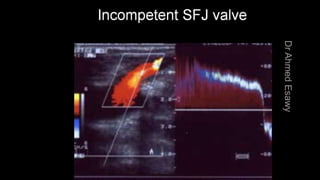 Duplex peripheral veins