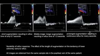 Duplex peripheral veins