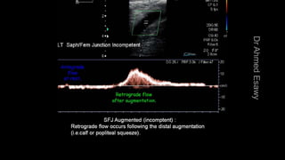 Duplex peripheral veins