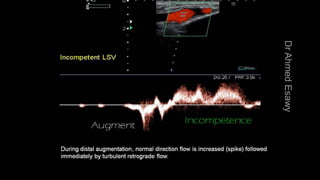Duplex peripheral veins