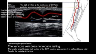 Duplex peripheral veins