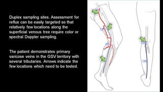 Duplex peripheral veins