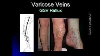 Duplex peripheral veins