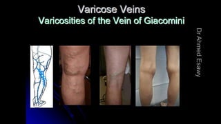 Duplex peripheral veins