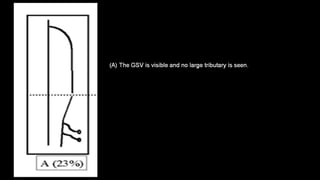 Duplex peripheral veins