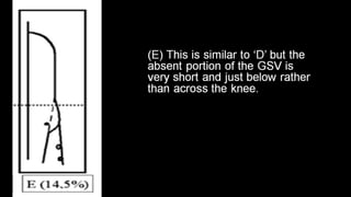Duplex peripheral veins