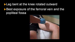 Duplex peripheral veins