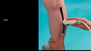 Duplex peripheral veins