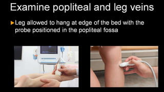 Duplex peripheral veins