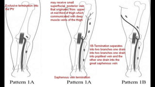Duplex peripheral veins