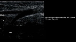 Duplex peripheral veins