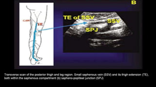 Duplex peripheral veins