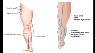 Duplex peripheral veins