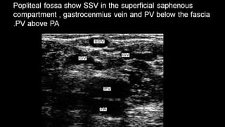 Duplex peripheral veins