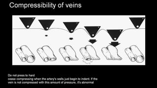Duplex peripheral veins