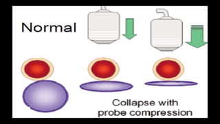 Duplex peripheral veins