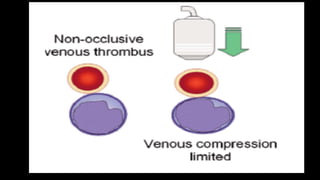 Duplex peripheral veins